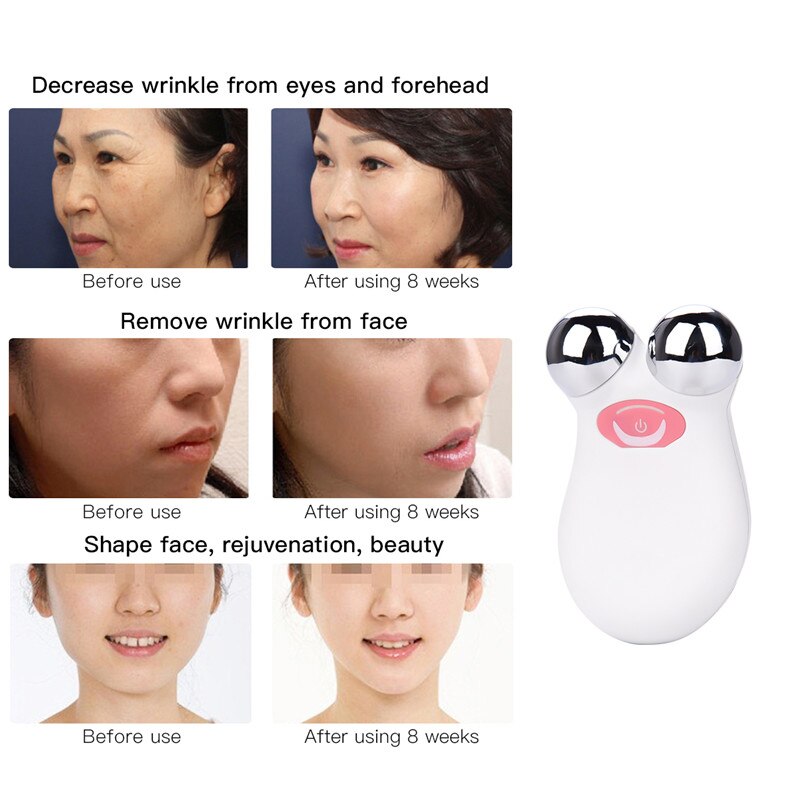 RosyGlow™ EMS Microcurrent Facial Lifting Wand